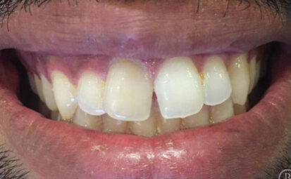 Before - Battersea Smiles