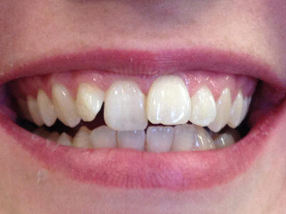 Before - Battersea Smiles