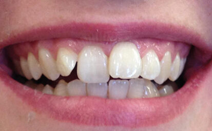 Before - Battersea Smiles