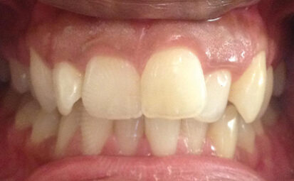 Before - Battersea Smiles