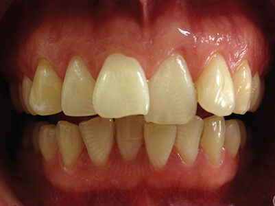 Before - Battersea Smiles
