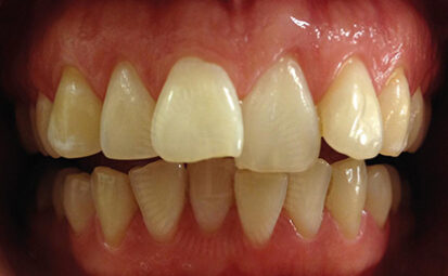 Before - Battersea Smiles