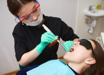 White composite fillings vs amalgam